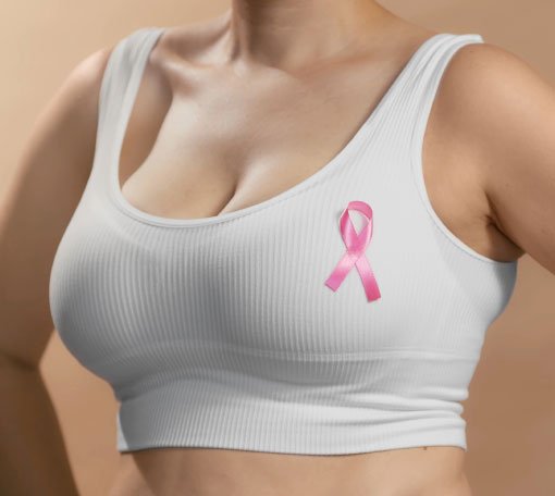 Formation pour la prise en charge en Kinésithérapie du Cancer du sein- MKNG Formations